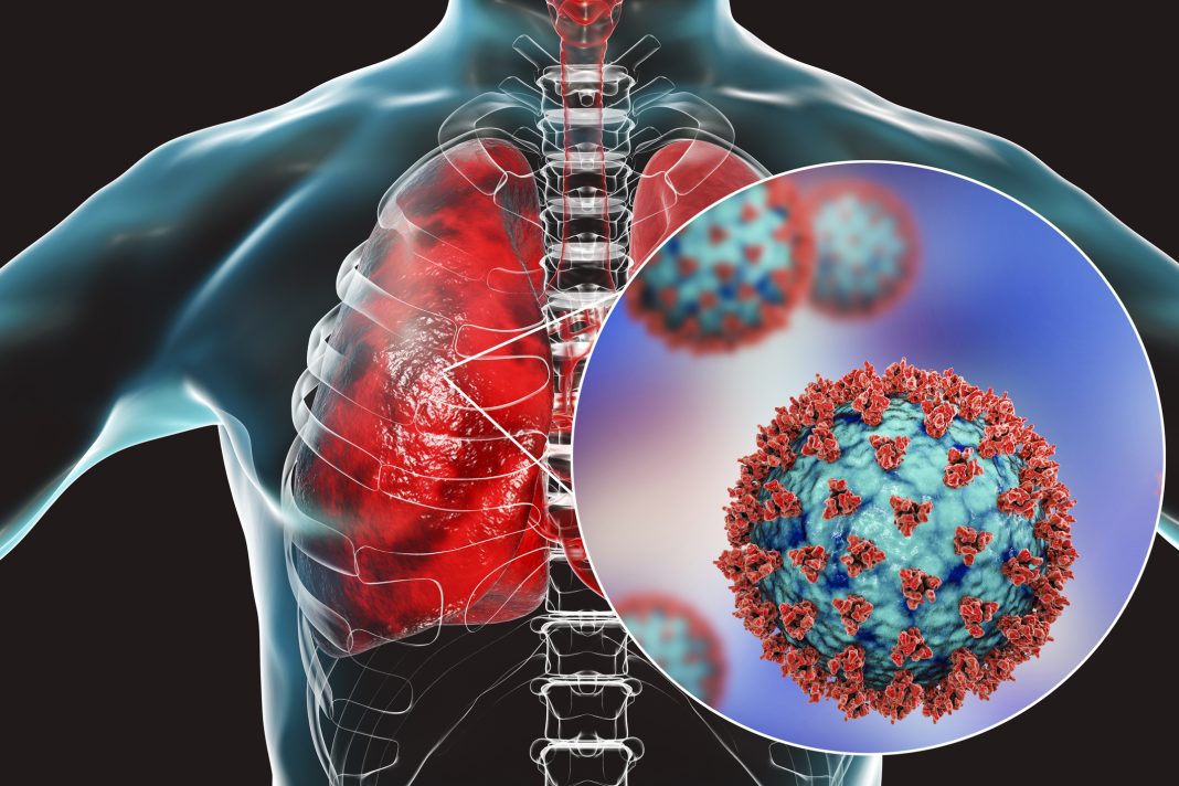 Causes, types and treatment of chest infection The Point