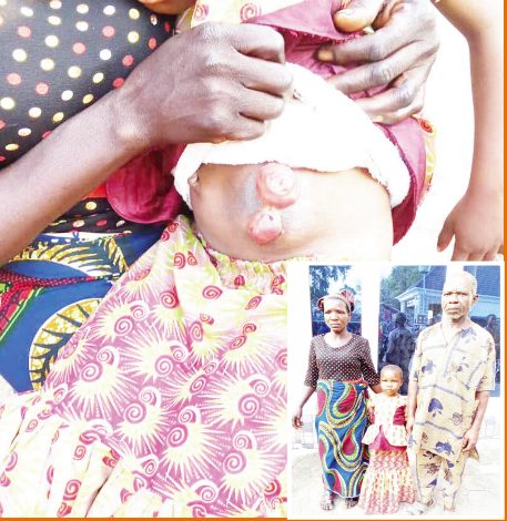 Couple seeks help for child with no reproductive organ, anus